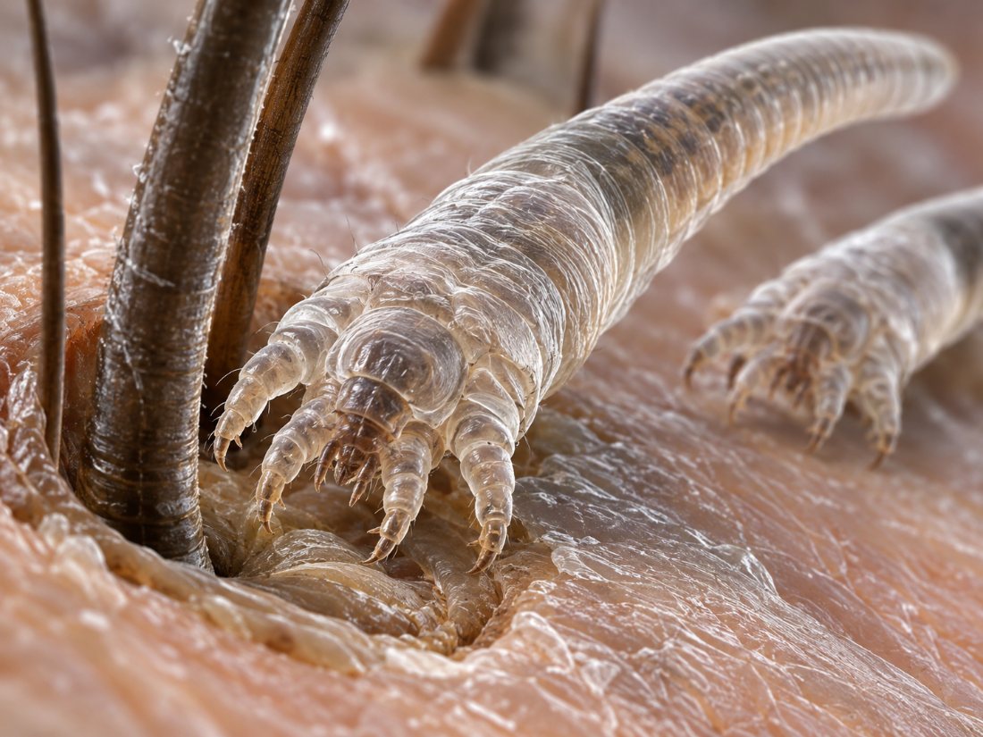 Vue très agrandie : acariens Demodex à l'entrée du follicule d'un cil