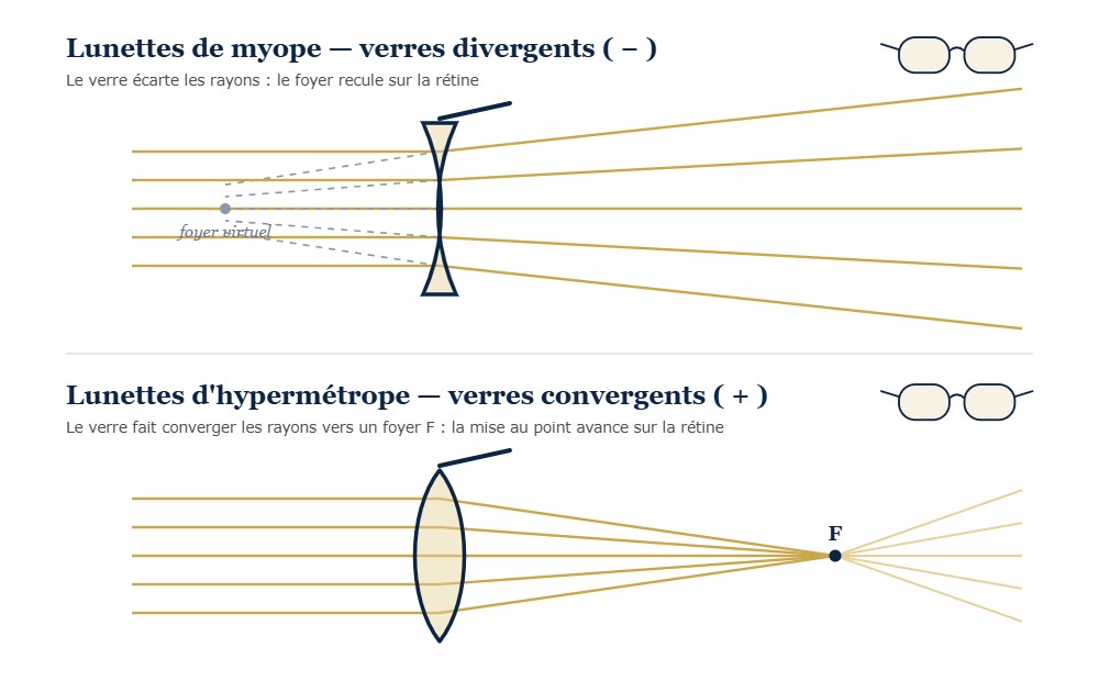 Schéma : des lunettes de myope à verres divergents écartent les rayons lumineux, des lunettes d'hypermétrope à verres convergents les font converger vers un foyer F